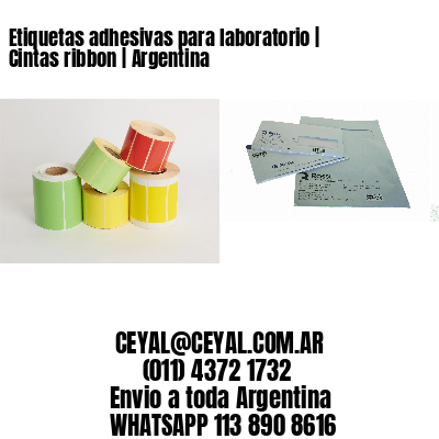 Etiquetas adhesivas para laboratorio | Cintas ribbon | Argentina