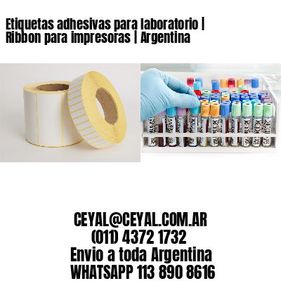 Etiquetas adhesivas para laboratorio | Ribbon para impresoras | Argentina