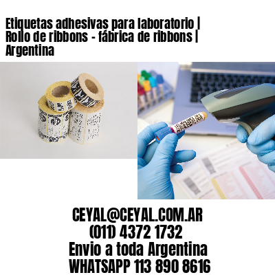 Etiquetas adhesivas para laboratorio | Rollo de ribbons – fábrica de ribbons | Argentina