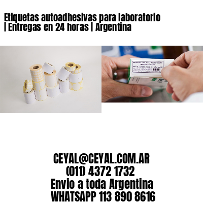 Etiquetas autoadhesivas para laboratorio | Entregas en 24 horas | Argentina
